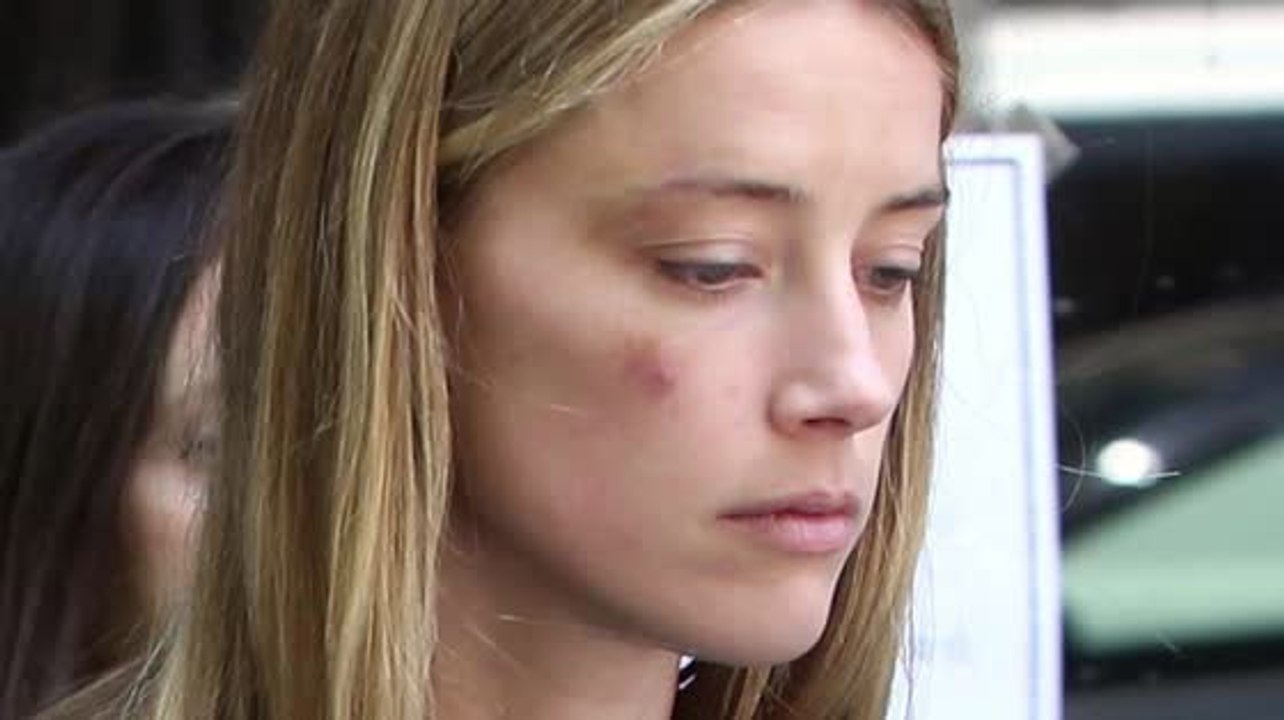 Die Polizisten behaupten, dass Amber Heard unverletzt war