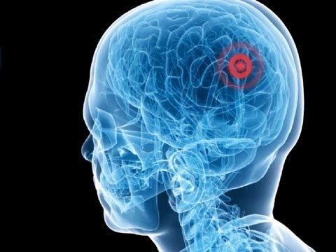 Yoav Medan: Ultrasound surgery healing without cuts