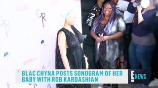 Blac Chyna and Rob Kardashians First Sonogram | E! News
