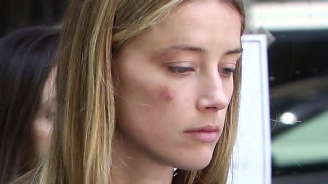 Los oficiales que respondieron al llamado de Amber Heard insisten que ella no tenía morados