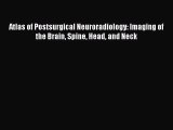 Read Atlas of Postsurgical Neuroradiology: Imaging of the Brain Spine Head and Neck Ebook Free