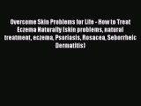 Read Overcome Skin Problems for Life - How to Treat Eczema Naturally (skin problems natural