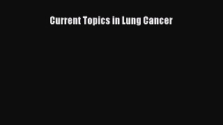 Download Current Topics in Lung Cancer Ebook Online