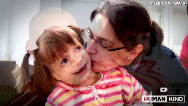 Ses proches voient le visage de son bébé et lui disent de l'abandonner! Puis ce qu'une inconnue fait est inimaginable!