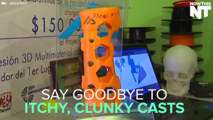 Revolutionary 3D Printed Waterproof Casts: Light, Durable & Faster Recovery 🚀