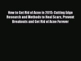 Download How to Get Rid of Acne in 2015: Cutting Edge Research and Methods to Heal Scars Prevent