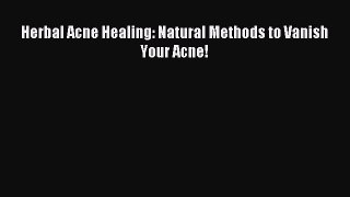 Read Herbal Acne Healing: Natural Methods to Vanish Your Acne! Ebook Online
