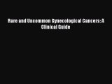 Download Rare and Uncommon Gynecological Cancers: A Clinical Guide PDF Online