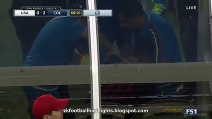James Rodríguez Horror Injury & Substitution HD - USA 0-2 Colombia 04.06.2016 HD