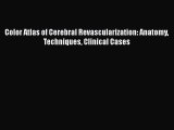 Read Color Atlas of Cerebral Revascularization: Anatomy Techniques Clinical Cases PDF Online