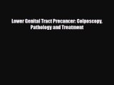PDF Lower Genital Tract Precancer: Colposcopy Pathology and Treatment [PDF] Online