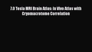 Download Books 7.0 Tesla MRI Brain Atlas: In Vivo Atlas with Cryomacrotome Correlation E-Book