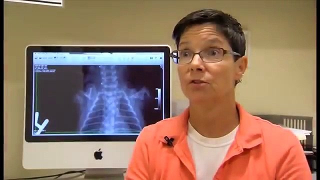 È Nato Senza Gambe, Ma Grazie A Degli Angeli Può Muovere I Suoi Primi Passi...