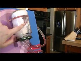 Understanding the Kidney: Working Model Explained 🩺