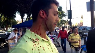 Trump supporter attacked in San Jose left bleeding