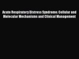 Read Acute Respiratory Distress Syndrome: Cellular and Molecular Mechanisms and Clinical Management