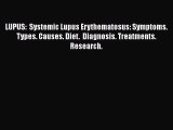 Read LUPUS:  Systemic Lupus Erythematosus: Symptoms. Types. Causes. Diet.  Diagnosis. Treatments.