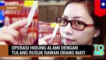 Operasi hidung dengan menggunakan tulang rusuk orang mati - Tomonews