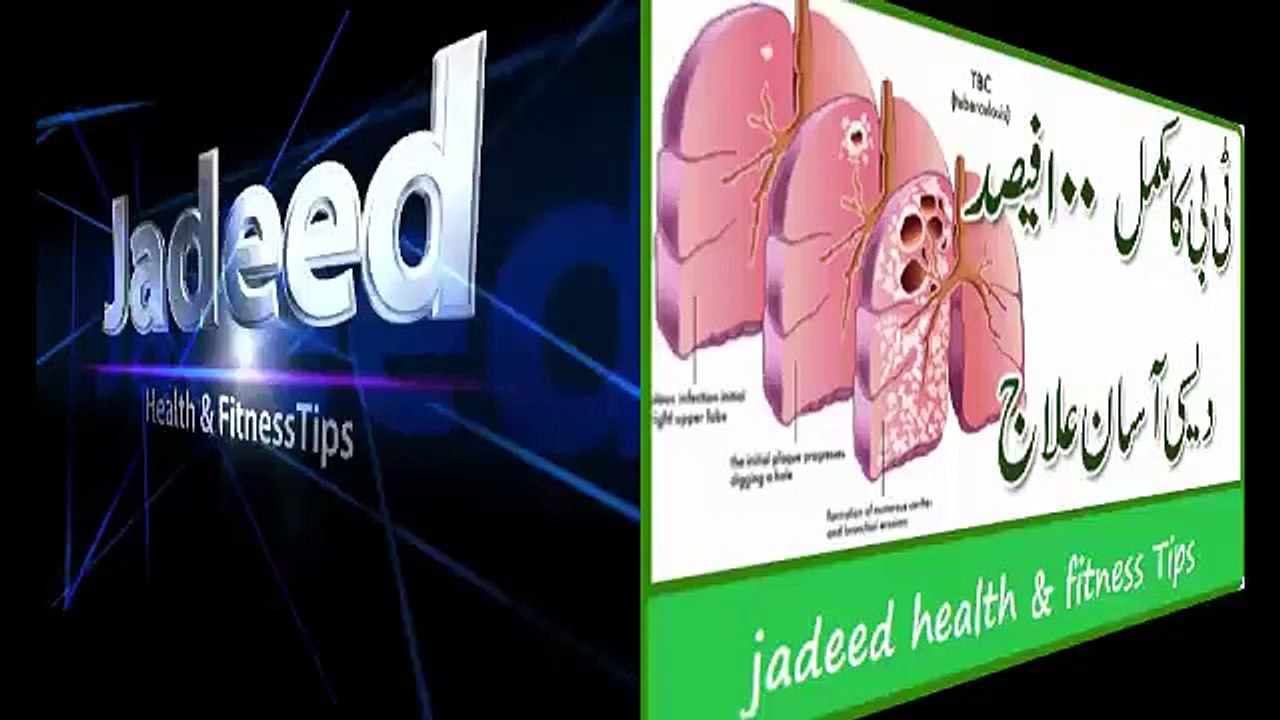 100 % Herbal treatment  of TB in Urdu¦TB ka Desi Herbal Kamyaab Illaj¦health tips