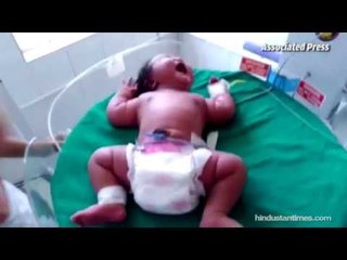 Meet the world's heaviest newborn