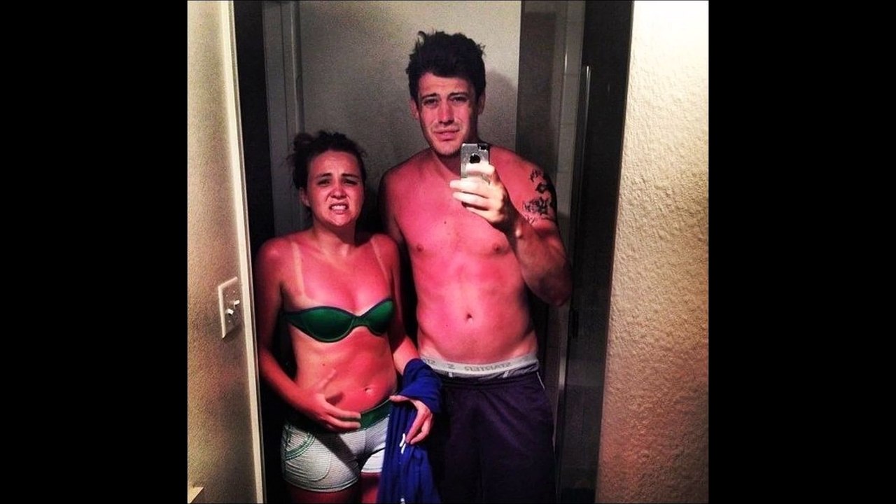 Abbronzature imbarazzanti...