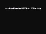 Read Functional Cerebral SPECT and PET Imaging Ebook Free