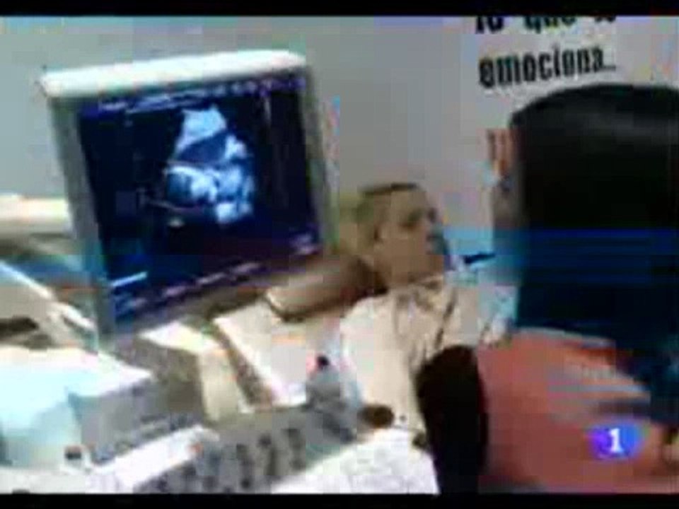 Ecox en TVE 23