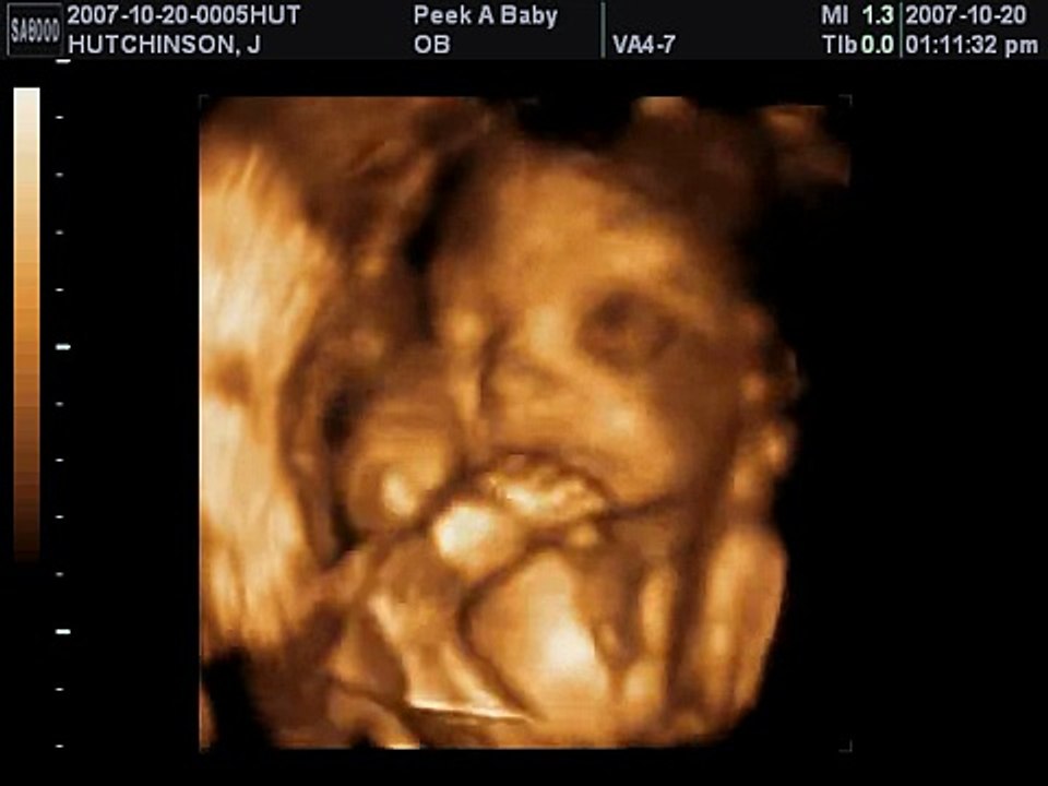 Cali's 4D Ultrasound 26 Weeks Pt.1