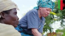 Albinos killed in Africa: Violence against albinos on the rise in Malawi - TomoNews