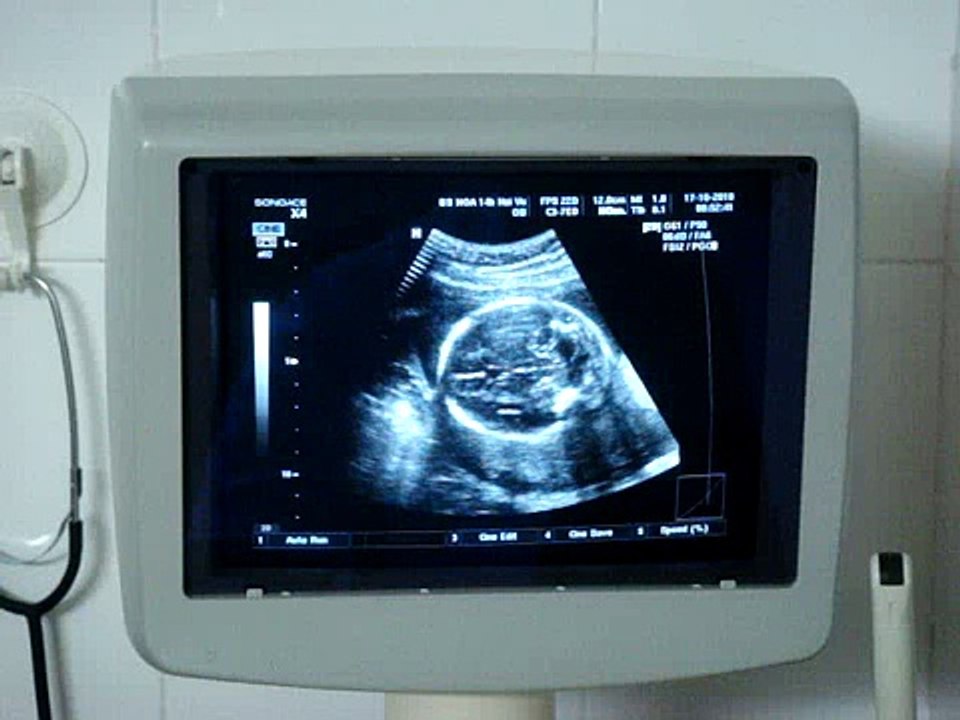 Cu Mít - Tuần thứ 24 trong bụng mẹ