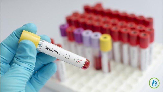 What is a sexually transmitted disease (or STD)?