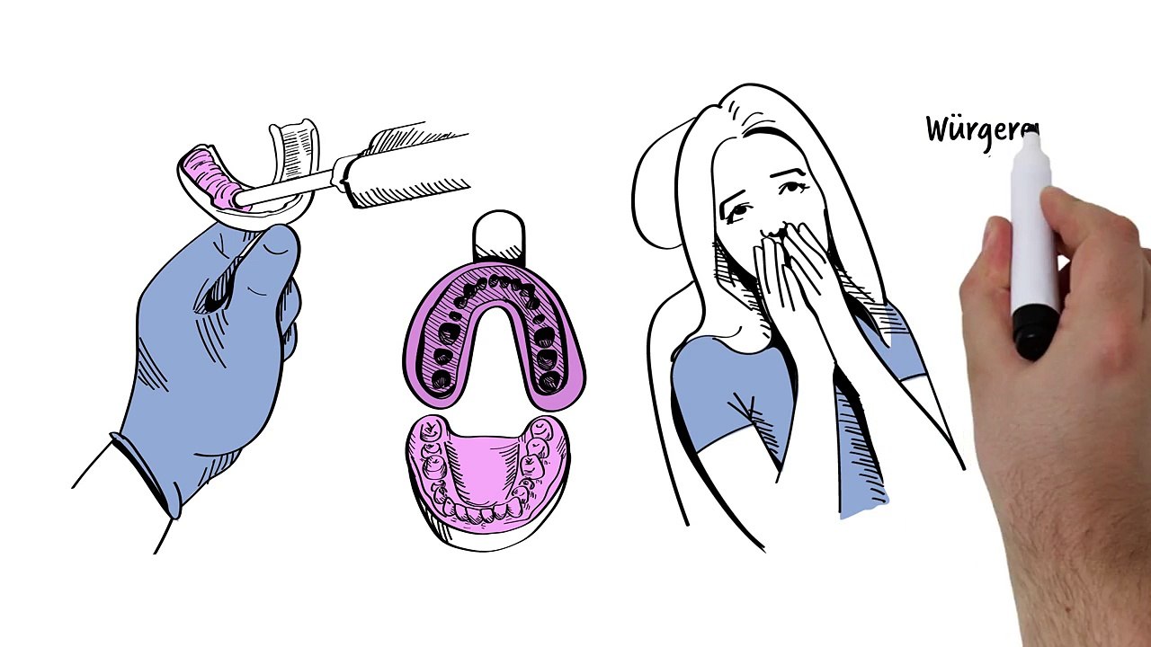 Zahnersatz mit cerec