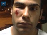 Jovem é atingido por estilhaço nas manifestações em Brasília