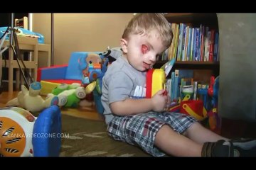 A miracle baby boy born with a severe birth defect