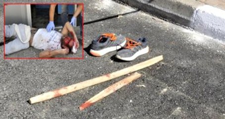 Antalya'da Fırında Bıçaklı Kavga: 4 Yaralı