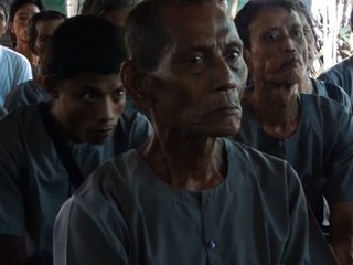 Leprosy: suffering in silence