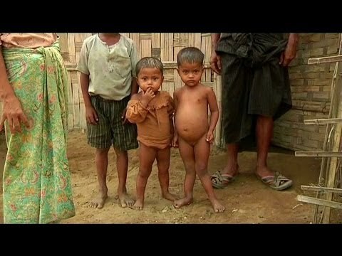 Children in Arakan State face malnutrition after aid workers' exodus