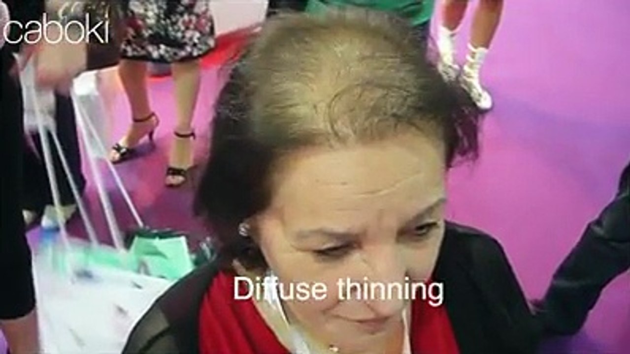 Grow your Hair in Less Than 3 Minutes.