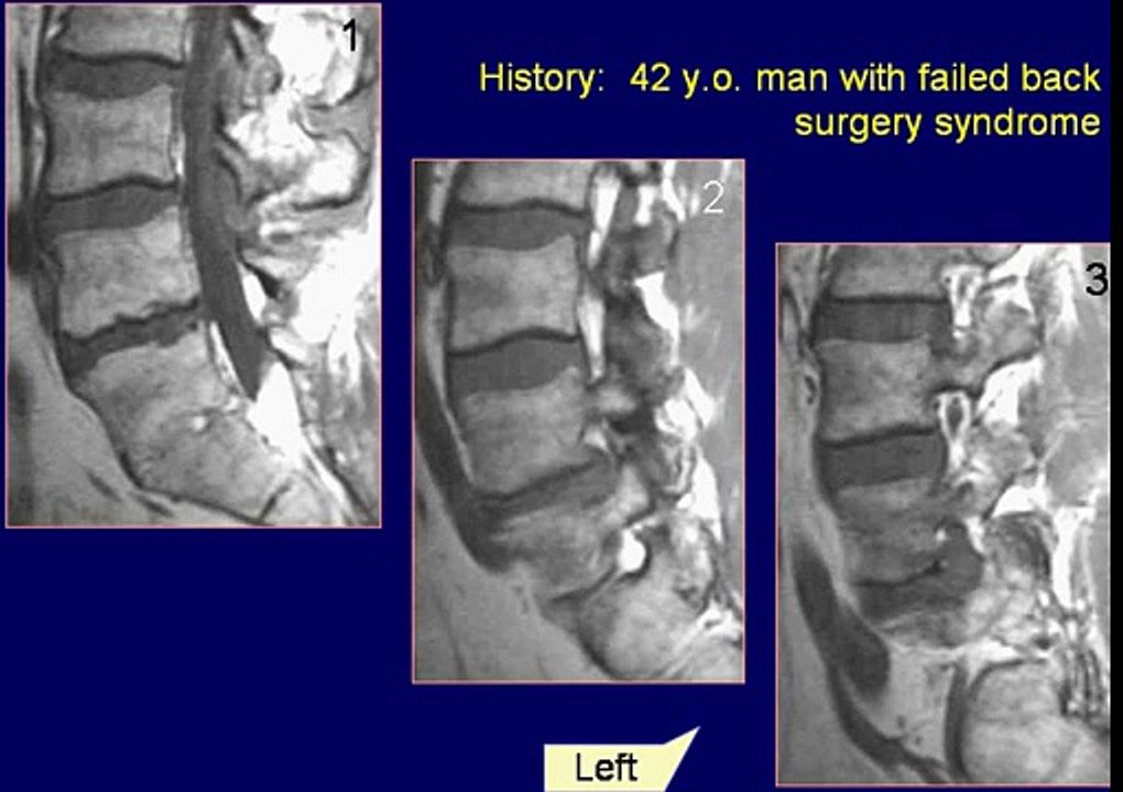 Neuroradiology Case 24