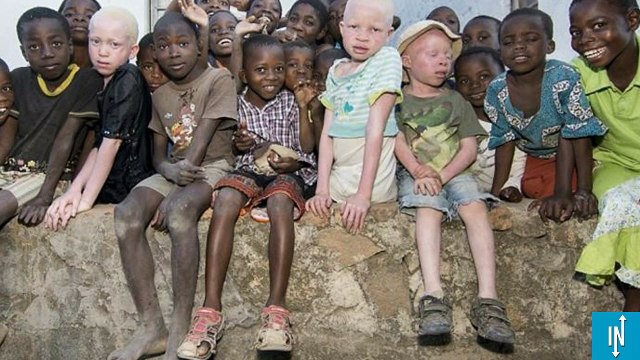 Le Malawi interdit enfin les sacrifices d'enfants albinos par des sorciers