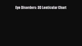Read Eye Disorders: 3D Lenticular Chart Ebook Free