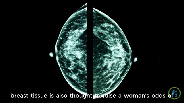 Teens Who Eat Saturated Fat Can Increase Risk For Breast Cancer, Study Finds