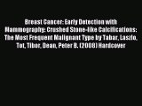 Read Breast Cancer: Early Detection with Mammography: Crushed Stone-like Calcifications: The