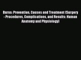 Read Burns: Prevention Causes and Treatment (Surgery - Procedures Complications and Results: