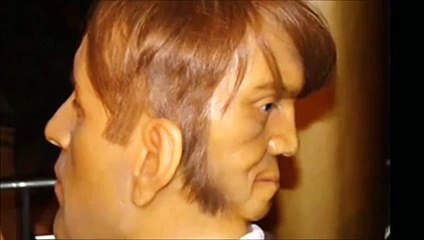 Edward Mordake - The man with two faces
