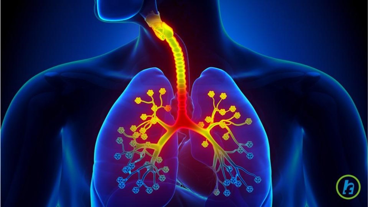 What is COPD? (Chronic obstructive pulmonary disease)