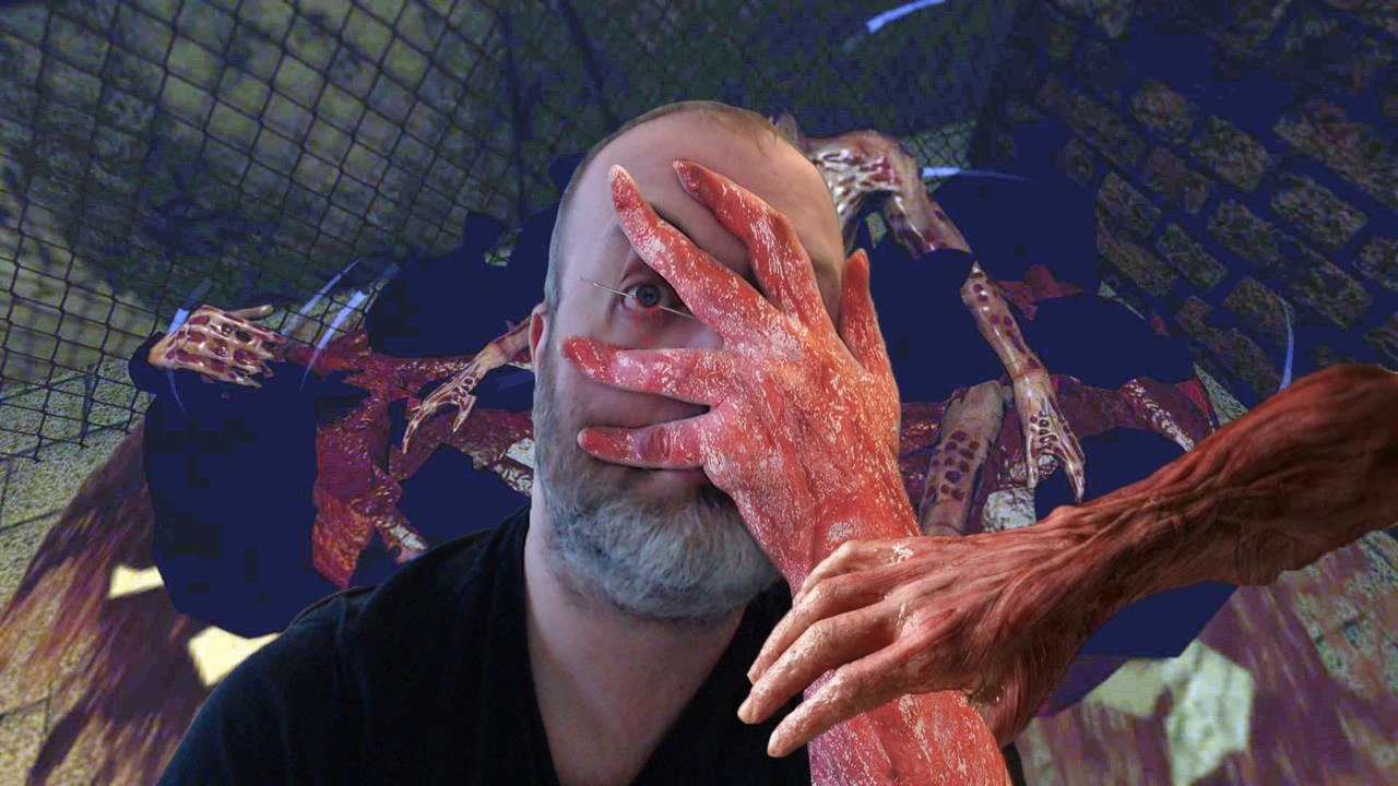 Skinned Alive | Wounded