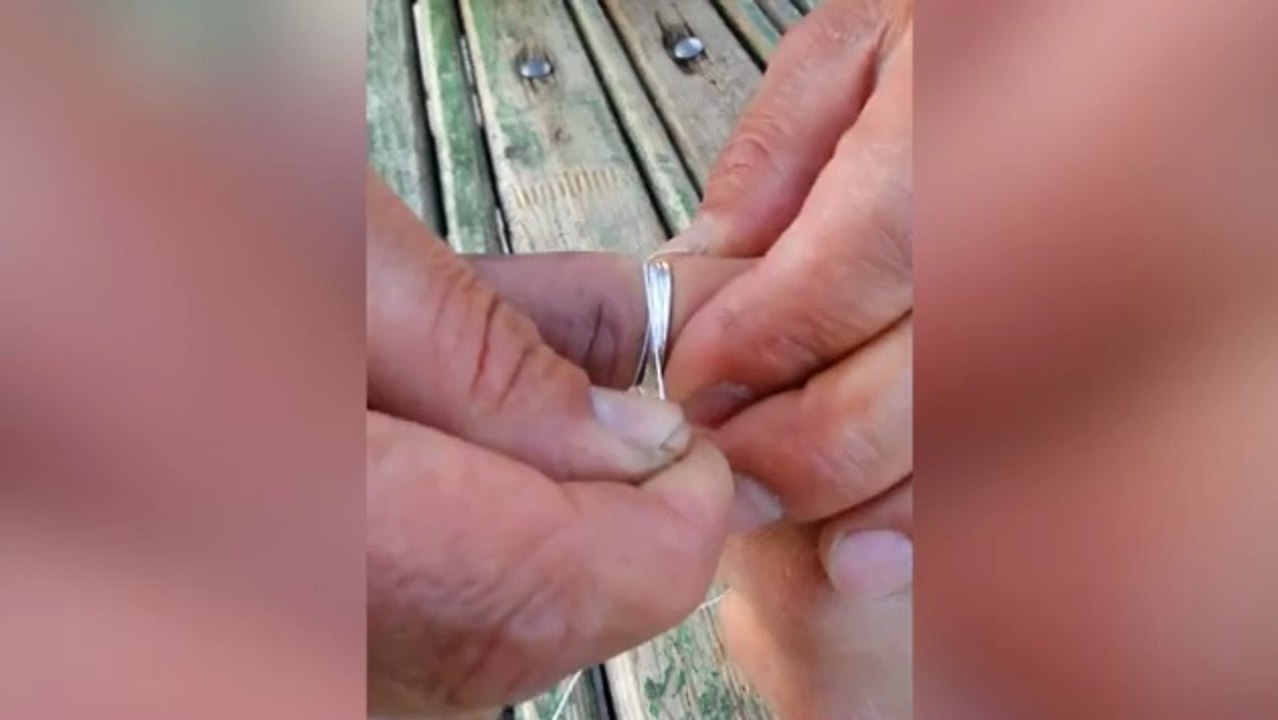 Amazing trick to remove a ring that is stuck on your finger