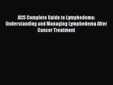 Read ACS Complete Guide to Lymphedema: Understanding and Managing Lymphedema After Cancer Treatment
