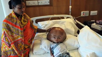 L'émouvante histoire de Roona, une petite Indienne miraculée